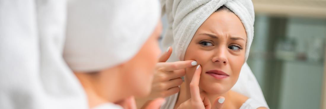 Here are 8 easy steps to cure pimples at home naturally: