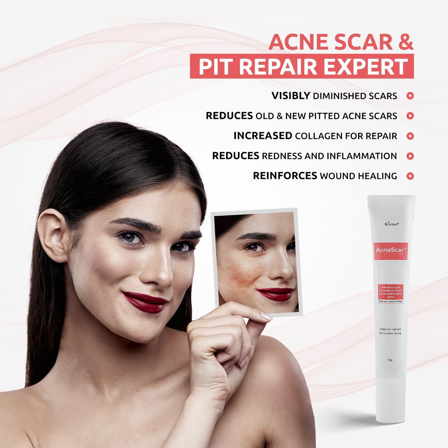 AcneScar Advanced Gel to Reduce Acne Scars associated with acne